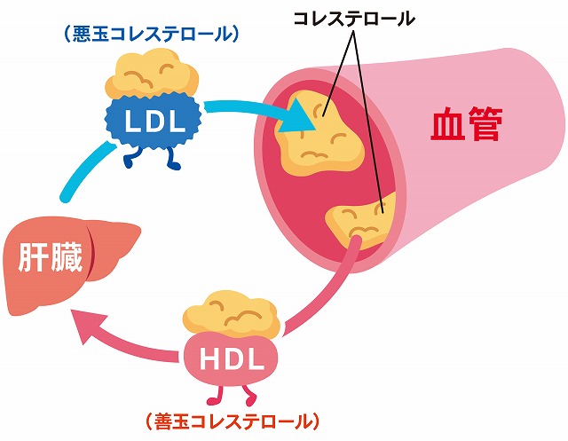 コレステロールの善玉と悪玉