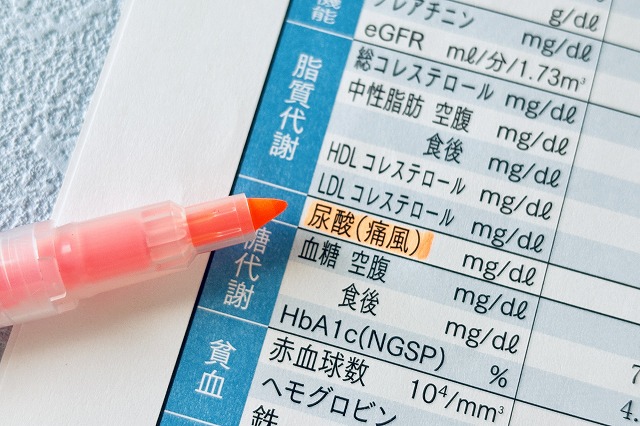 尿酸値が高いとは？